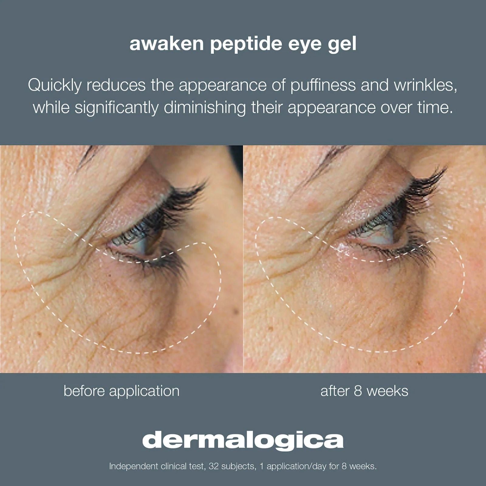 Dermalogica | Awaken Peptide Eye Gel 15ml - Image 2