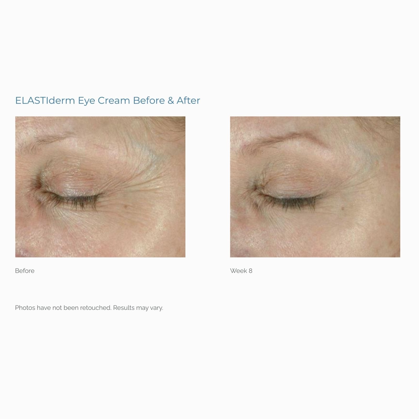 Obagi | ELASTIderm Eye Cream 15g - Image 5